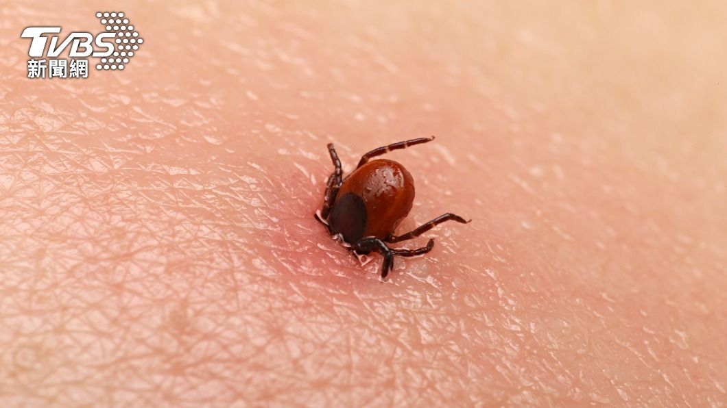 蜱蟲俗稱「壁蝨」或「八腳怪」，遭叮咬恐患萊姆病。（示意圖／Shutterstock達志影像）