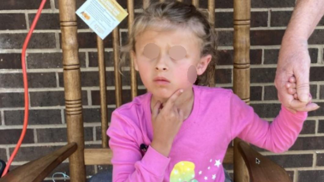 6歲女童金斯莉（Kinsley White）遭槍擊臉頰中彈，送醫後逢了好幾針。（圖／翻攝自《太陽報》）