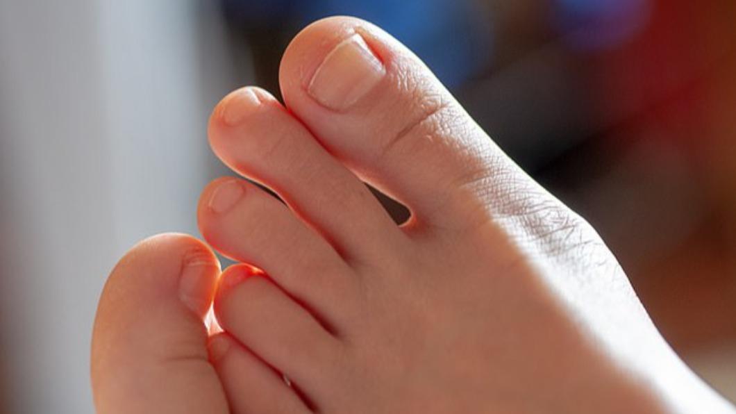 腳趾甲變得脆弱或生長緩慢，可能是血液膽固醇濃度過高所致。（示意圖／shutterstock達志影像）