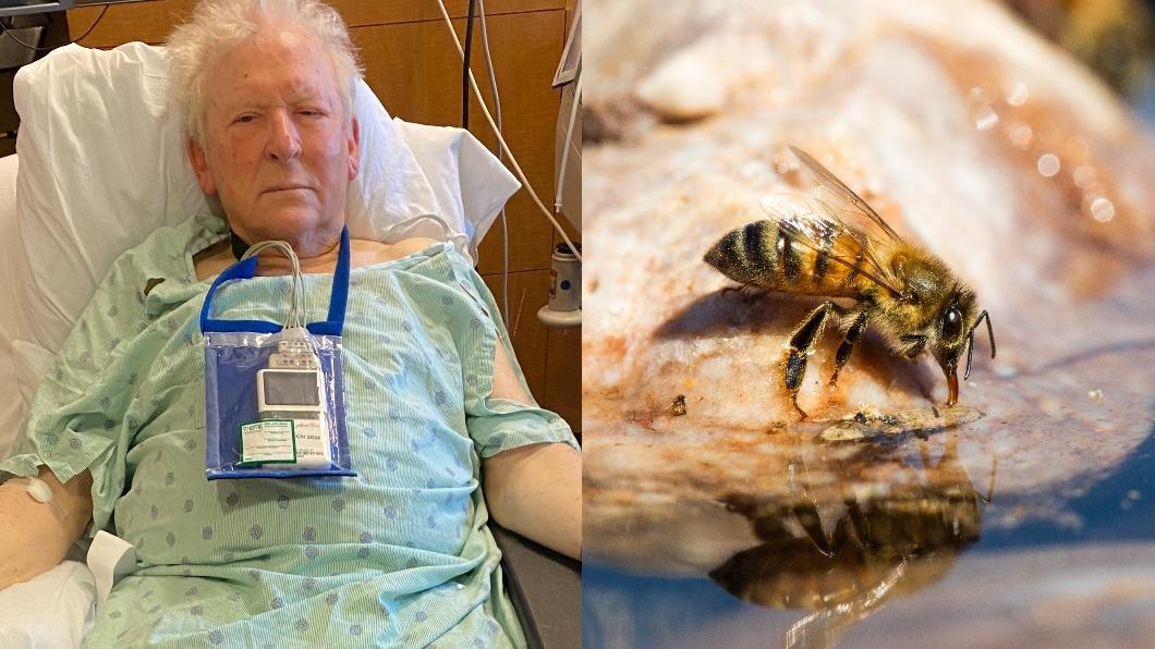 美國奧克拉荷馬州一名81歲老翁遭殺人蜂狂螫3小時，醫生從他體內清出200多根毒針。（圖／翻攝自@ChrisYuNews9推特、shutterstock達志影像）