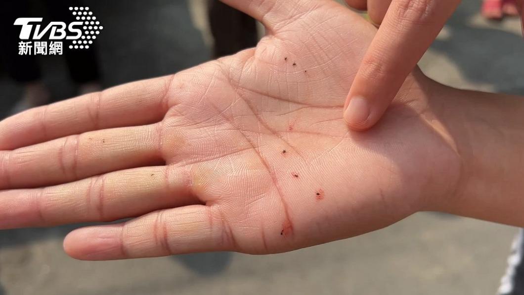 被蚊子叮咬別用手「打死」。（示意圖／TVBS資料照）