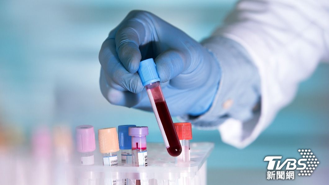 美國臨床實驗公司奎斯特診斷公司（Quest Diagnostics）推出血液檢查，以偵測出β澱粉樣蛋白（amyloid beta）的異常值。（示意圖／達志影像Shutterstock）