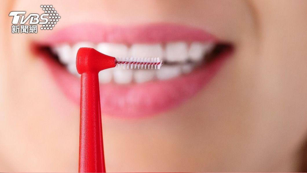 牙醫分享牙間刷正確選擇方式。（示意圖／shutterstock達志影像）