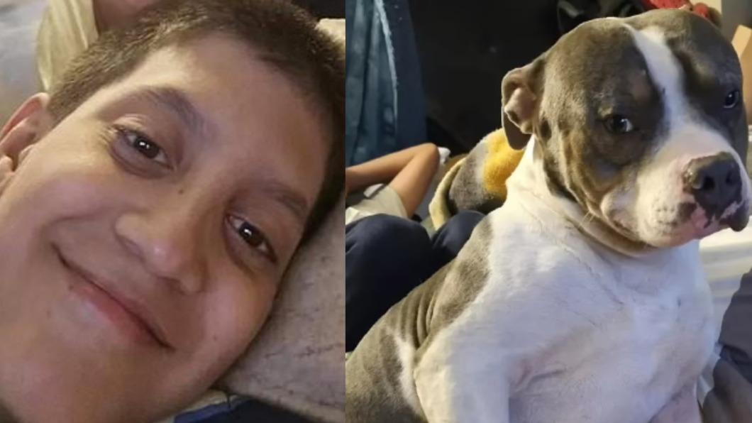 紐約11歲少年遭到阿姨的治療犬攻擊。（圖／翻攝自每日郵報）