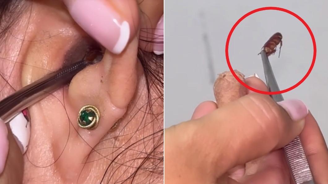哥倫比亞1名女子的耳朵竟夾出1隻蟑螂。（圖／翻攝自TikTok@paulaavalos）