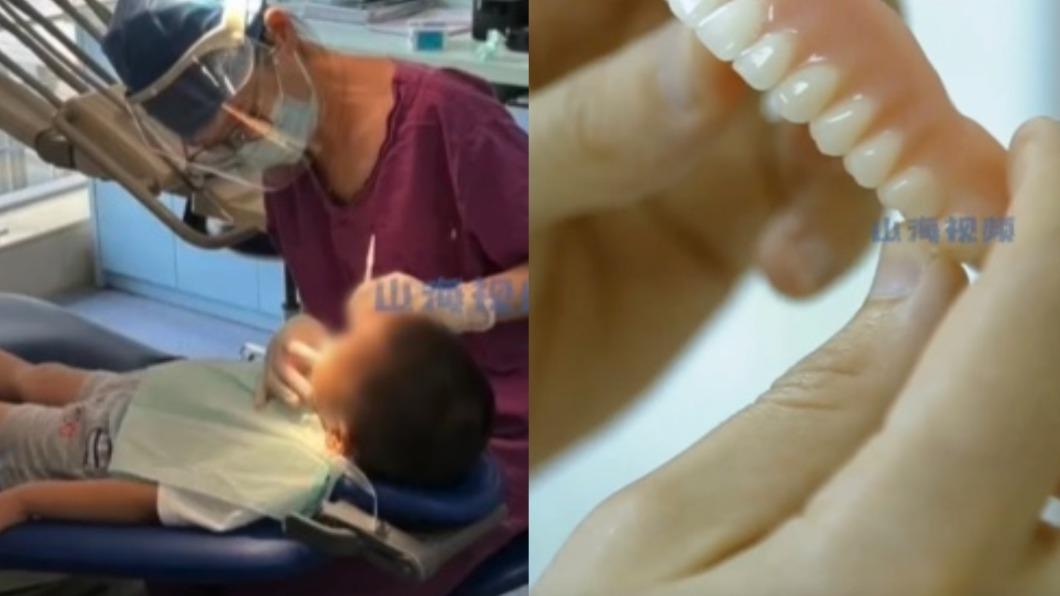 14歲少年滿口蛀牙嚇壞牙醫。（圖／翻攝自微博《山海視頻》）