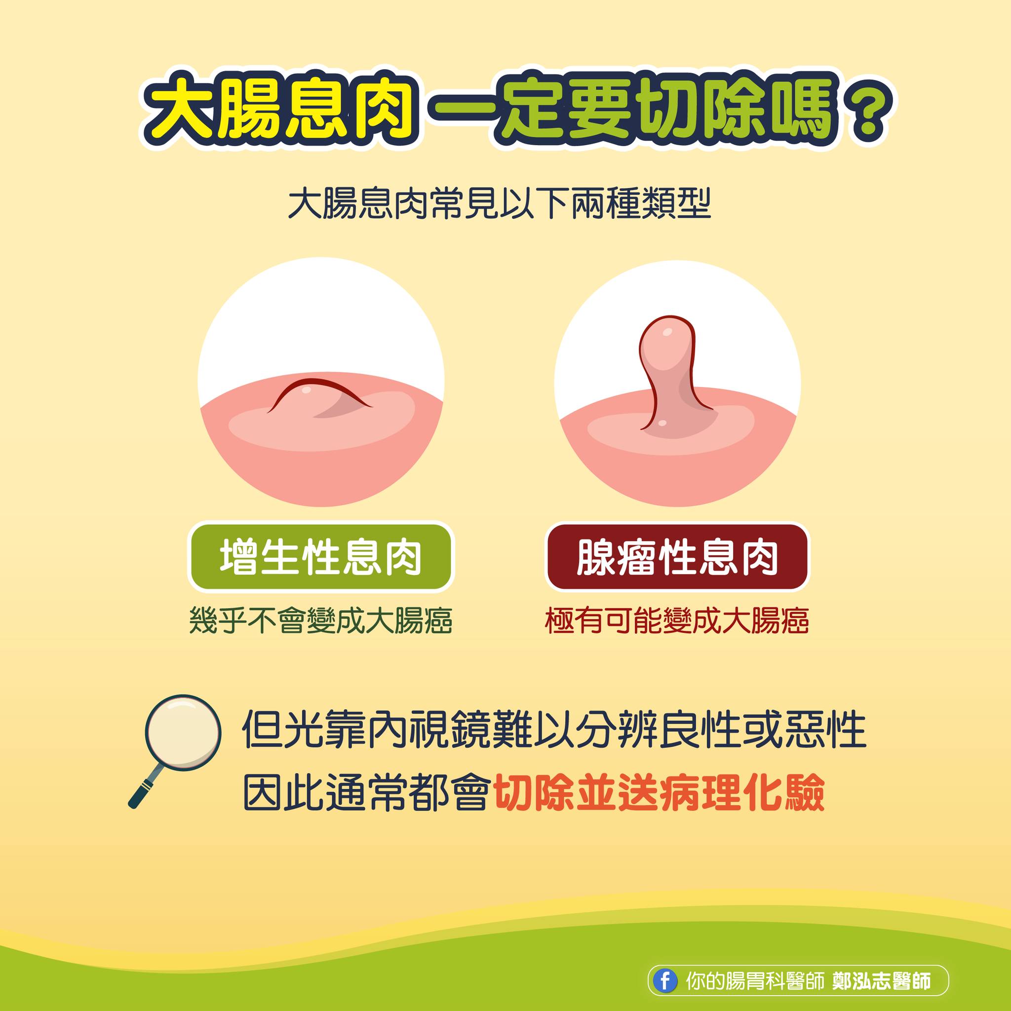 腺瘤性息肉極有可能發展成大腸癌。（圖／翻攝自鄭泓志醫師粉專）