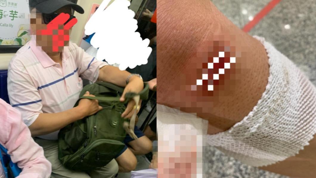 網友分享自己腳受傷仍被要求讓座的經歷。（圖／翻攝自@爆怨公社　臉書）