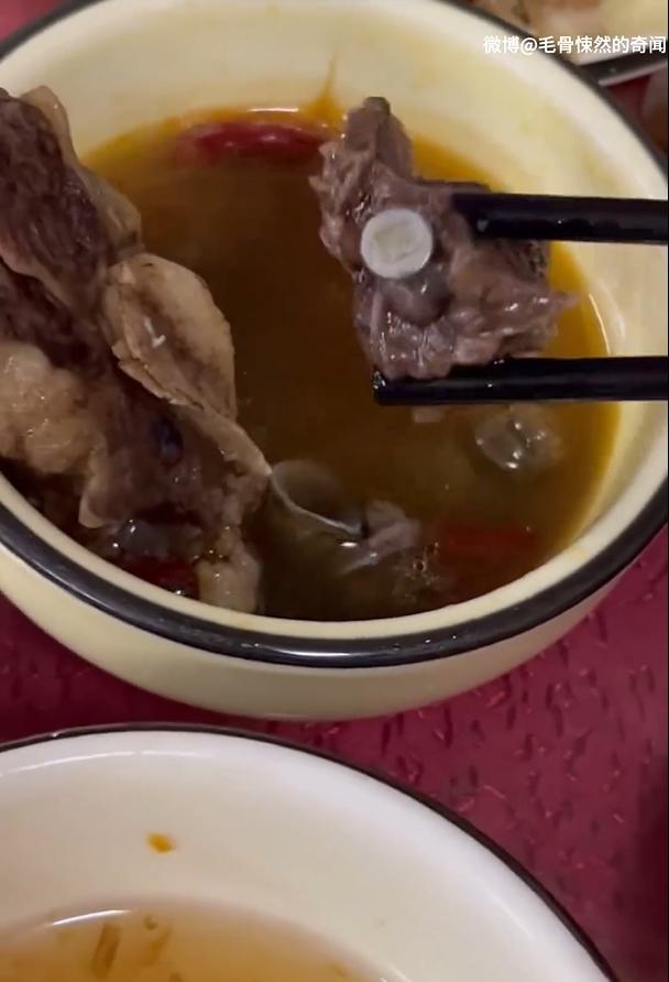 鋼釘直接嵌在肉裡。(圖/翻攝自微博)