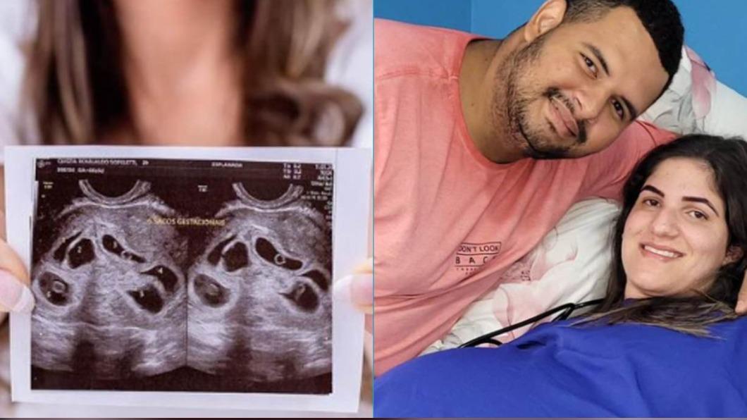 巴西1名孕婦在10分鐘內產下6名嬰兒。（圖／翻攝自Twitter@RevistaISTOE）
