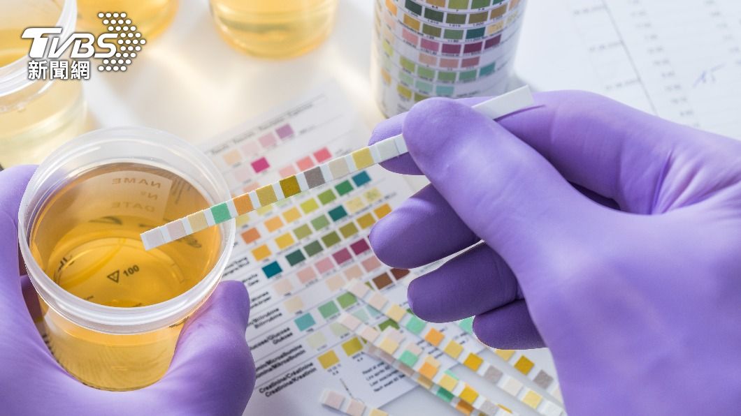 尿液顏色不是越淡越好。（圖／shutterstock達志影像）