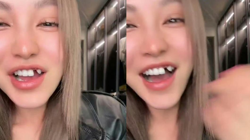周揚青看演唱會出事!「吃掉一顆牙」嚇壞 缺牙照瘋傳笑了:沒齒難忘│TVBS新聞網