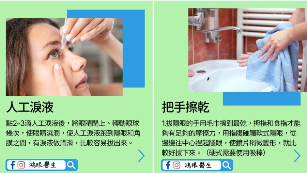 醫師分享拔隱眼2妙招。(圖/翻攝自鴻眼醫生|林宜鴻眼科醫師臉書)