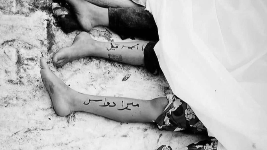 加薩罹難兒童的腿上，寫著自己的名字。（圖／翻攝自Ｘ@mohamedel24）