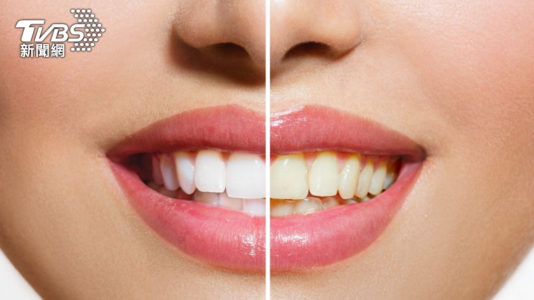 想擁有一口潔白牙齒，不僅要仔細清潔，日常飲食習慣也有注意。（示意圖／shutterstock達志影像） 