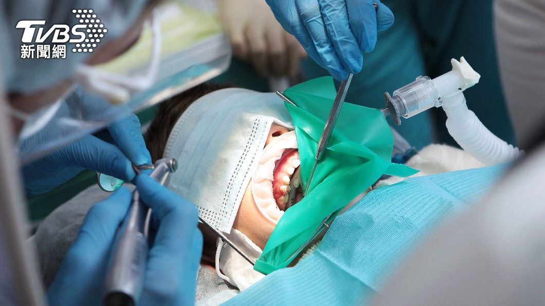 印尼女拔牙後因傷口感染喪命。（示意圖／Shutterstock達志影像）