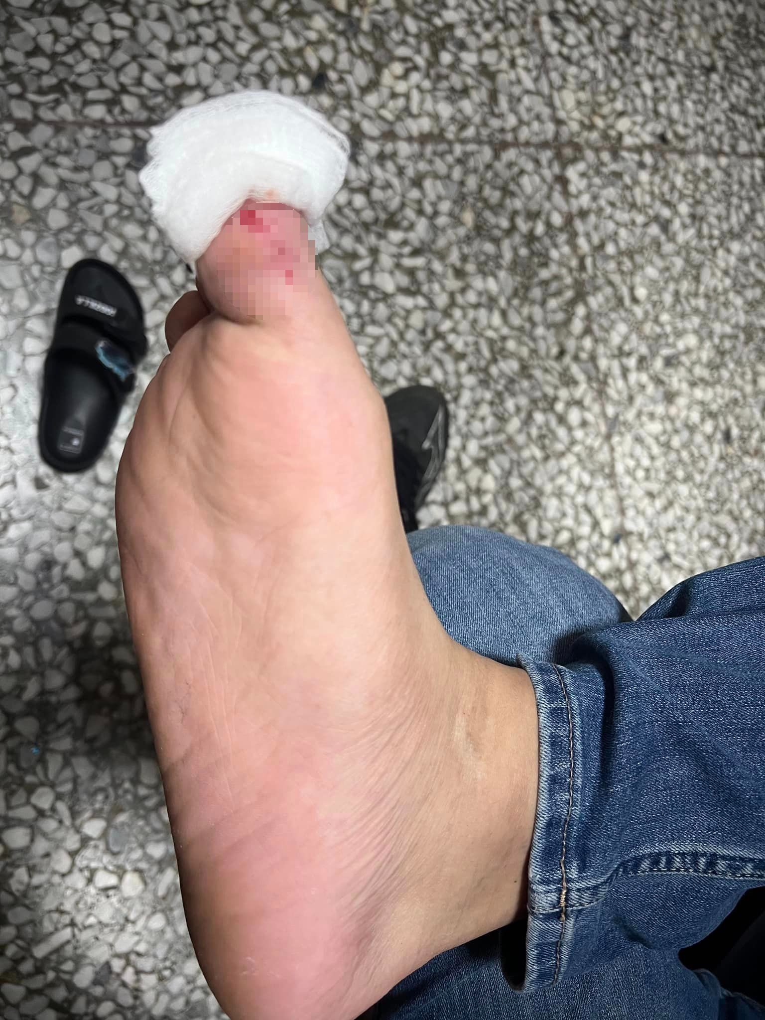 消費者腳底遭到溫泉池底刮傷。(圖/翻攝自花蓮同鄉會臉書社團)