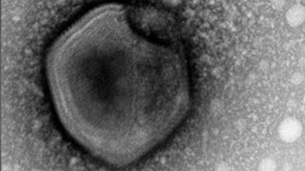永凍土中的病毒復活後，都能感染人工培育的單細胞變形蟲。（圖／翻攝自研究報告）