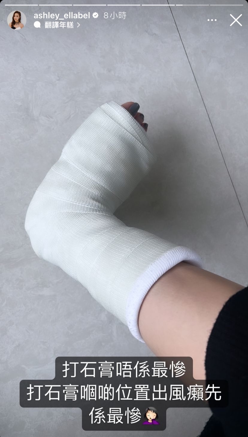 朱智賢忍痛8天才求醫，才發現是骨裂並打石膏。（圖／翻攝自朱智賢IG）