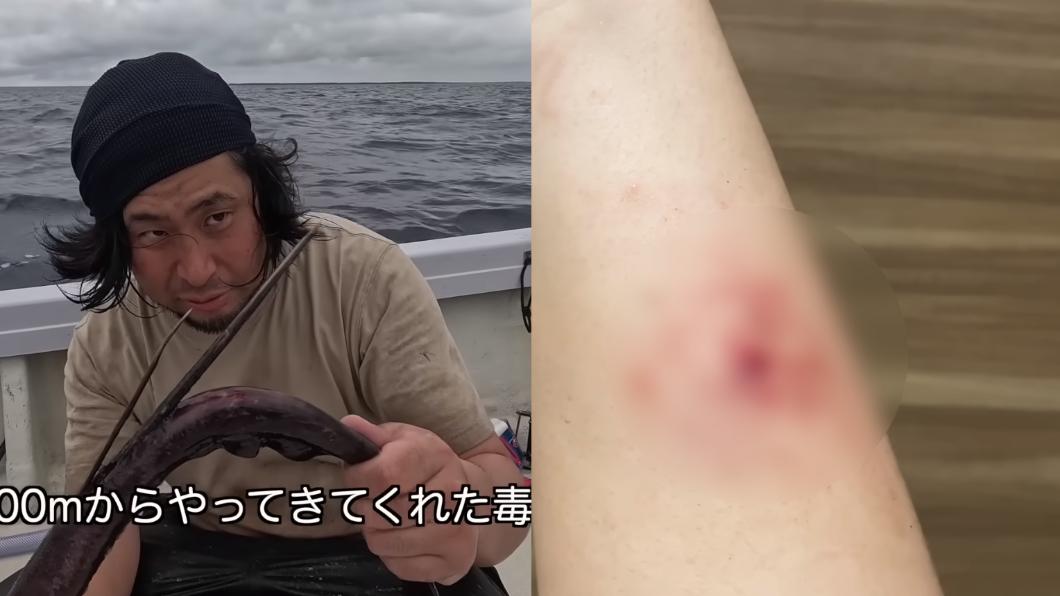 平坂寛表示，魟魚的毒刺刺入手臂後5個小時，他仍能感覺到麻痺感，且傷口反覆流血。（圖／翻攝自平坂寛YT頻道）