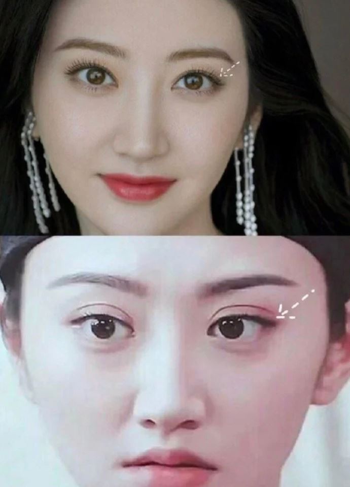 景甜如今的雙眼皮顯得浮腫。（圖／翻攝自微博）