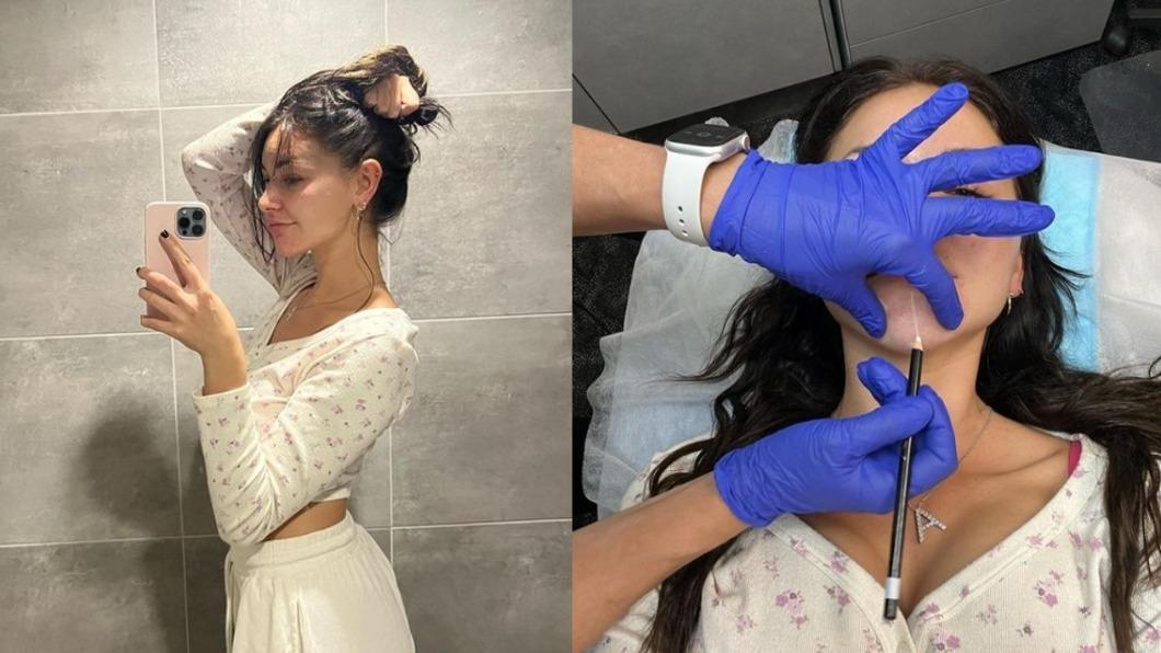 安娜分享手術照。（圖／翻攝自IG@anna_paull）