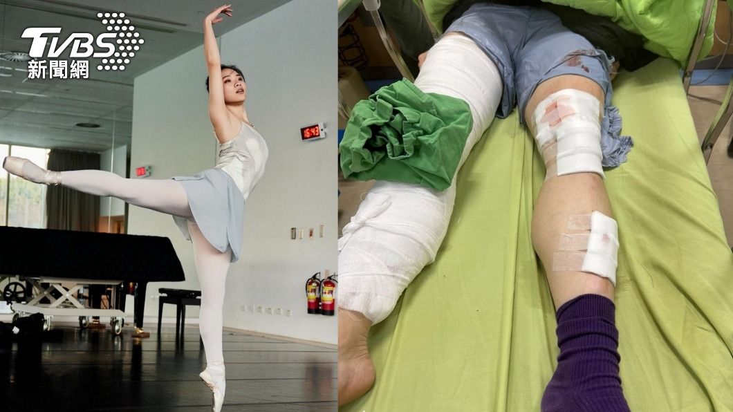 陳姓女芭蕾舞者遭車禍波及重傷。（圖／翻攝當事人Threads）