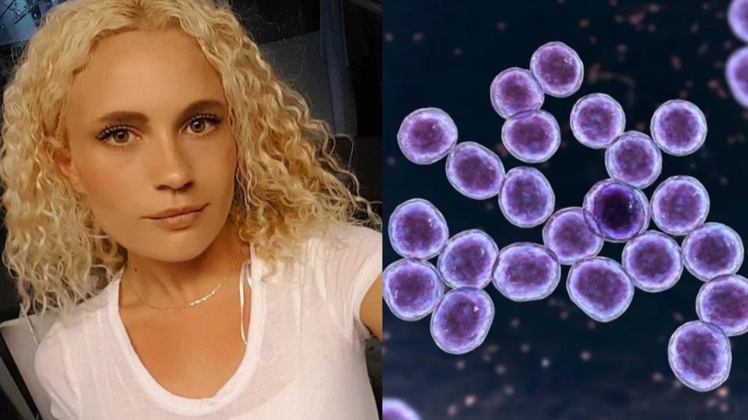 澳洲29歲女子艾希莉（Ashley Timbery）感染「超級細菌」。（圖／翻攝自《每日郵報》、newscientist）