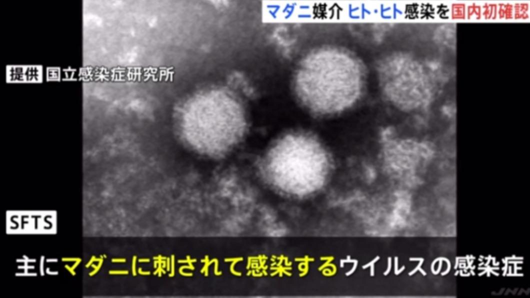 日本國內首度確認蜱媒病毒傳染病「發熱伴血小板減少綜合症」（簡稱SFTS）人傳人案例。（圖／翻攝TBS）