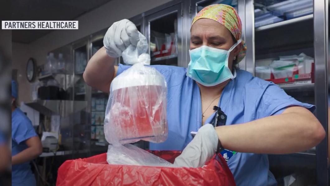美國波士頓醫療團隊成功將基因改造的豬腎，移植入一名長年洗腎的病患體內。（圖／翻攝自WKYC Channel 3新聞影片）