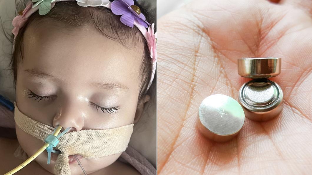 美國有名9個月大的女嬰意外吞下鈕扣電池。（圖／翻攝自X@MailOnline、達志影像shutterstock）