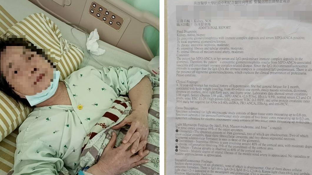  國內疑首例！70歲嬤吃「小林紅麴」急性腎衰竭　衛生局回應