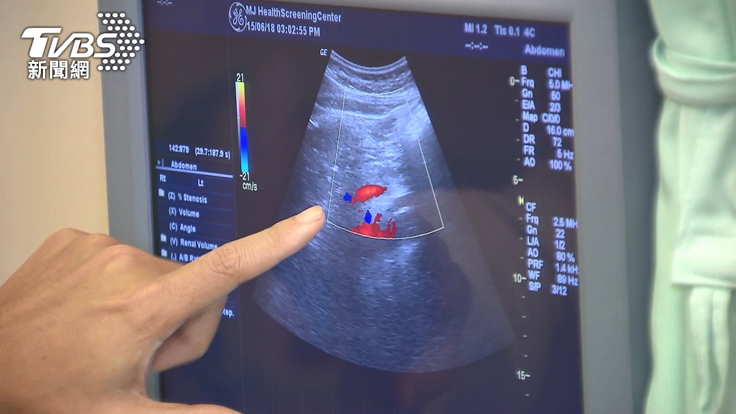 Re: [問卦] 很瘦的同事說他脂肪肝