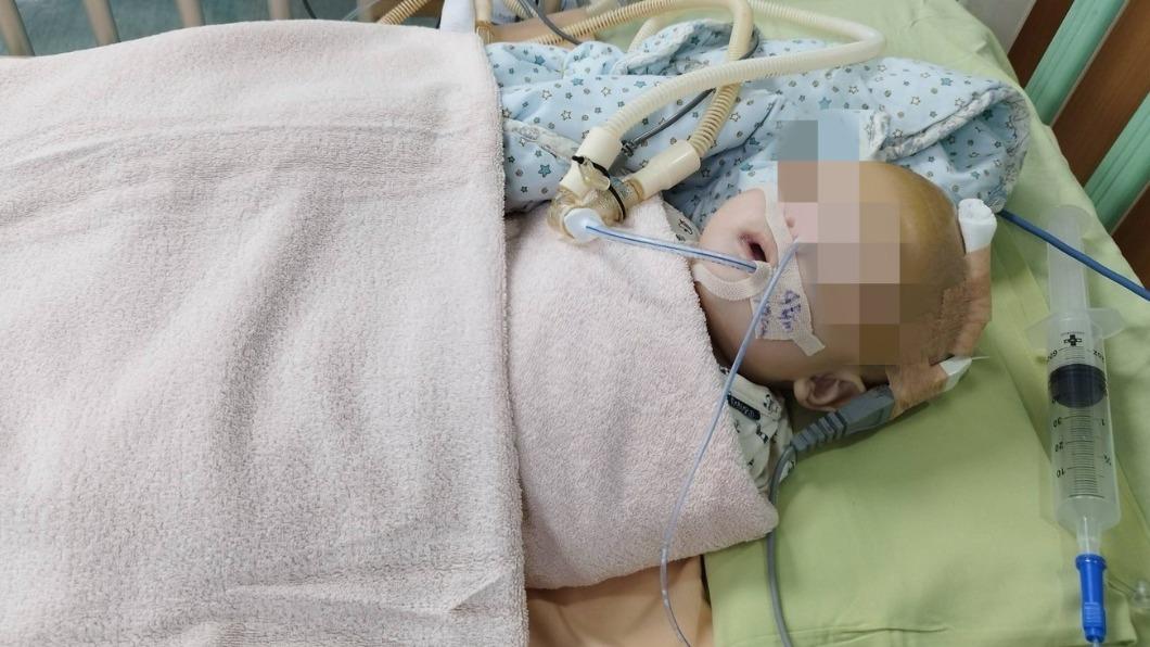 高雄5個月大的男嬰「洋洋」頭骨碎裂、至今仍在加護病房。（圖／家長提供）