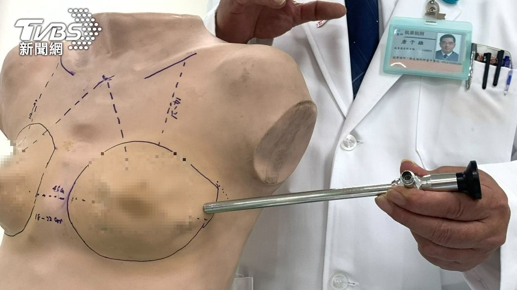 醫師替病患執行單孔內視鏡乳房全切除暨重建手術。（圖／TVBS）