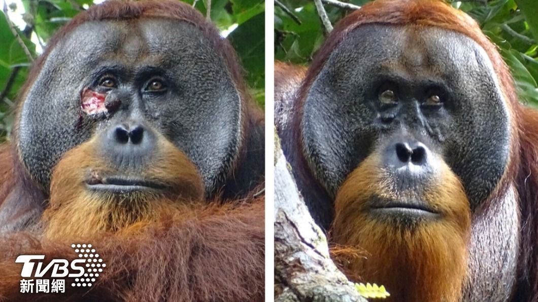 名為拉庫斯的雄性蘇門答臘猩猩被發現會咀嚼藥用植物，塗抹於臉上的傷口後康復。（圖／達志影像美聯社）