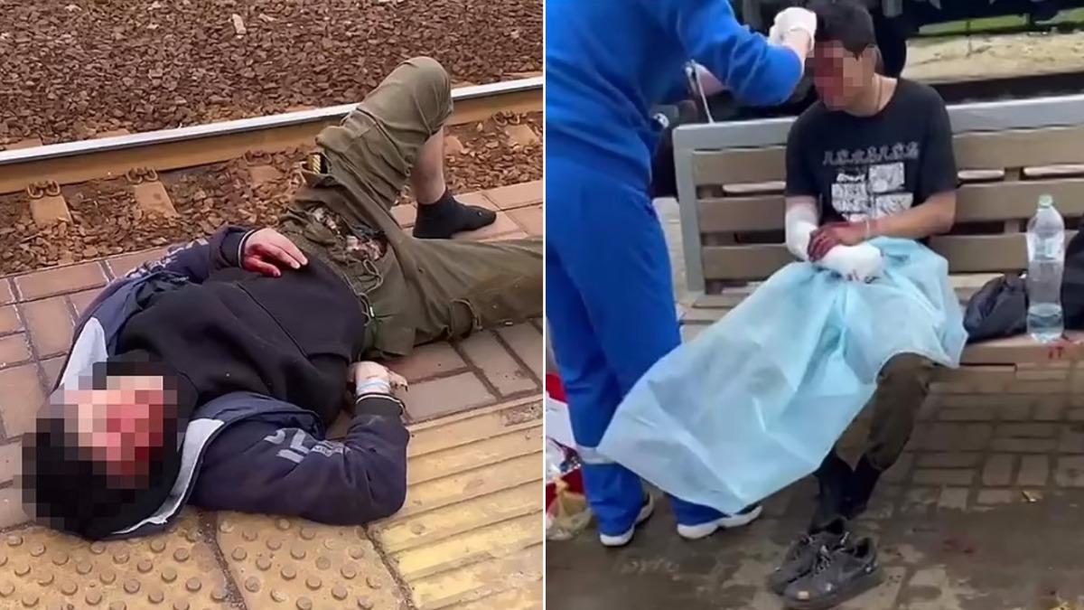 俄羅斯這名少年為了拍片竟直接爬上火車頂，沒想到觸電後全身被燒傷。（圖／翻攝自East2West News）