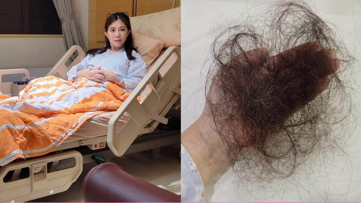 小彤住院接受化療嚴重落髮。 （圖／翻攝自小彤臉書）