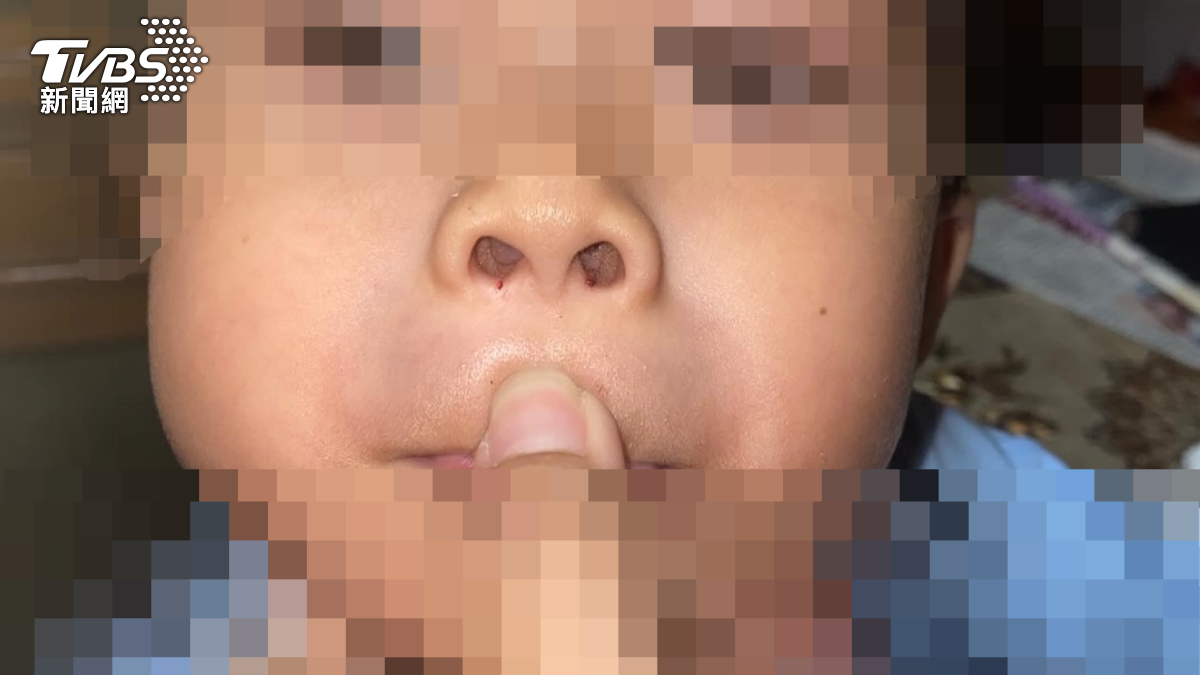 男童雙鼻之間出現不明血跡。（圖／民眾提供）