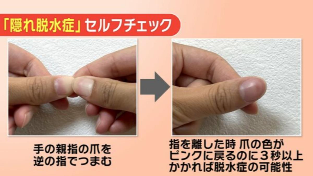 按壓大拇指指甲後，若指甲花3秒以上時間才恢復粉紅色，可能就是隱性缺水。（圖／翻攝自福島TUF）