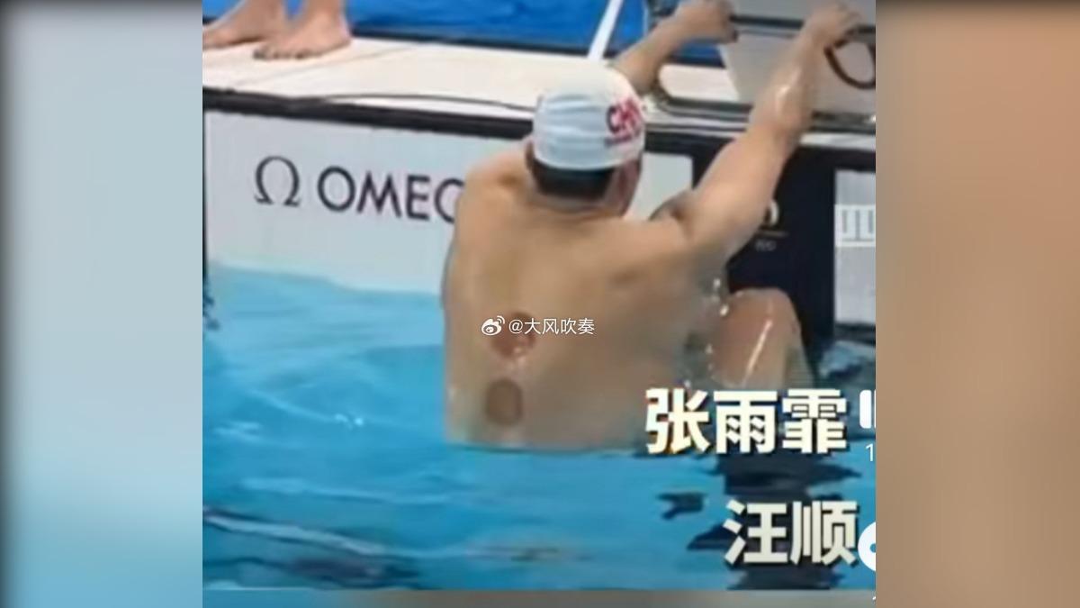 中國游泳隊賽前訓練畫面中，包含汪順等選手背上，都出現一圈圈拔罐留下的痕跡。（圖／翻攝自微博）