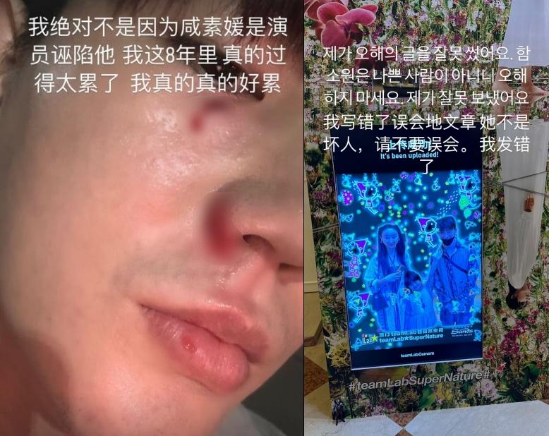 陳華昨天曬完瘀青照之後，今天又改口要大家別誤會太太。（圖／翻攝自當事人IG）