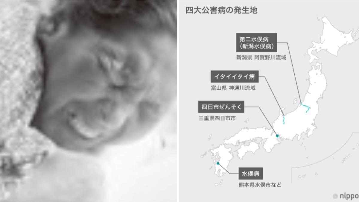 日本4大污染病「痛痛病」的93歲女性患者去世，感染者首次歸零。（示意圖／擷取自nippon.com）	