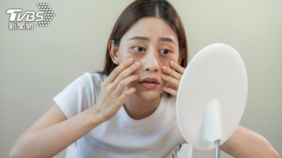 許多人因為黑眼圈而感到困擾。（示意圖／shutterstock 達志影像）