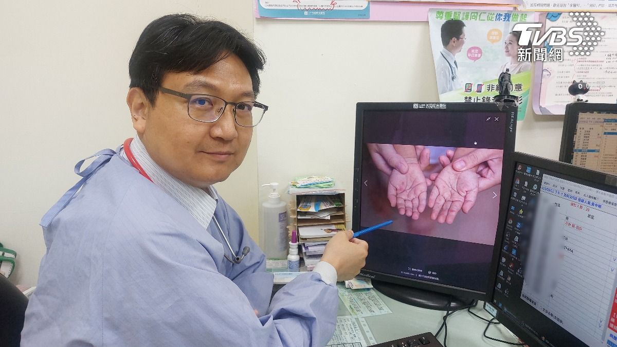 光田綜合醫院大甲院區兒科副主任黃中明醫師。（圖／TVBS）