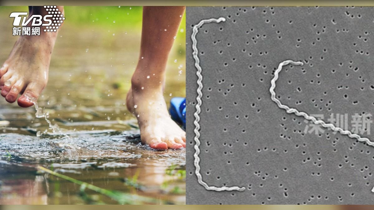 陸男下雨後光腳走路罹怪病。（圖左／shutterstock 達志影像，圖右／翻攝自 微博）