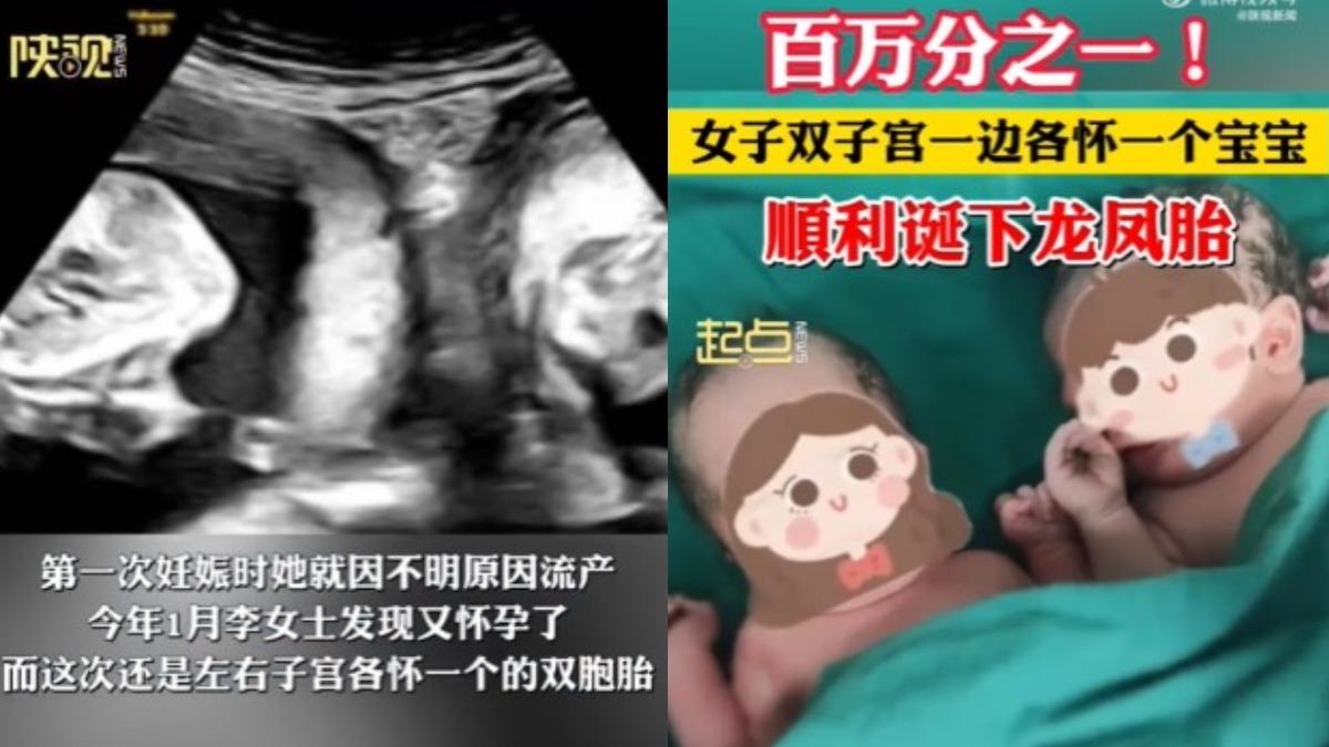 雙子宮孕婦順利產下龍鳳胎。（圖／翻攝自微博《陝視新聞》）