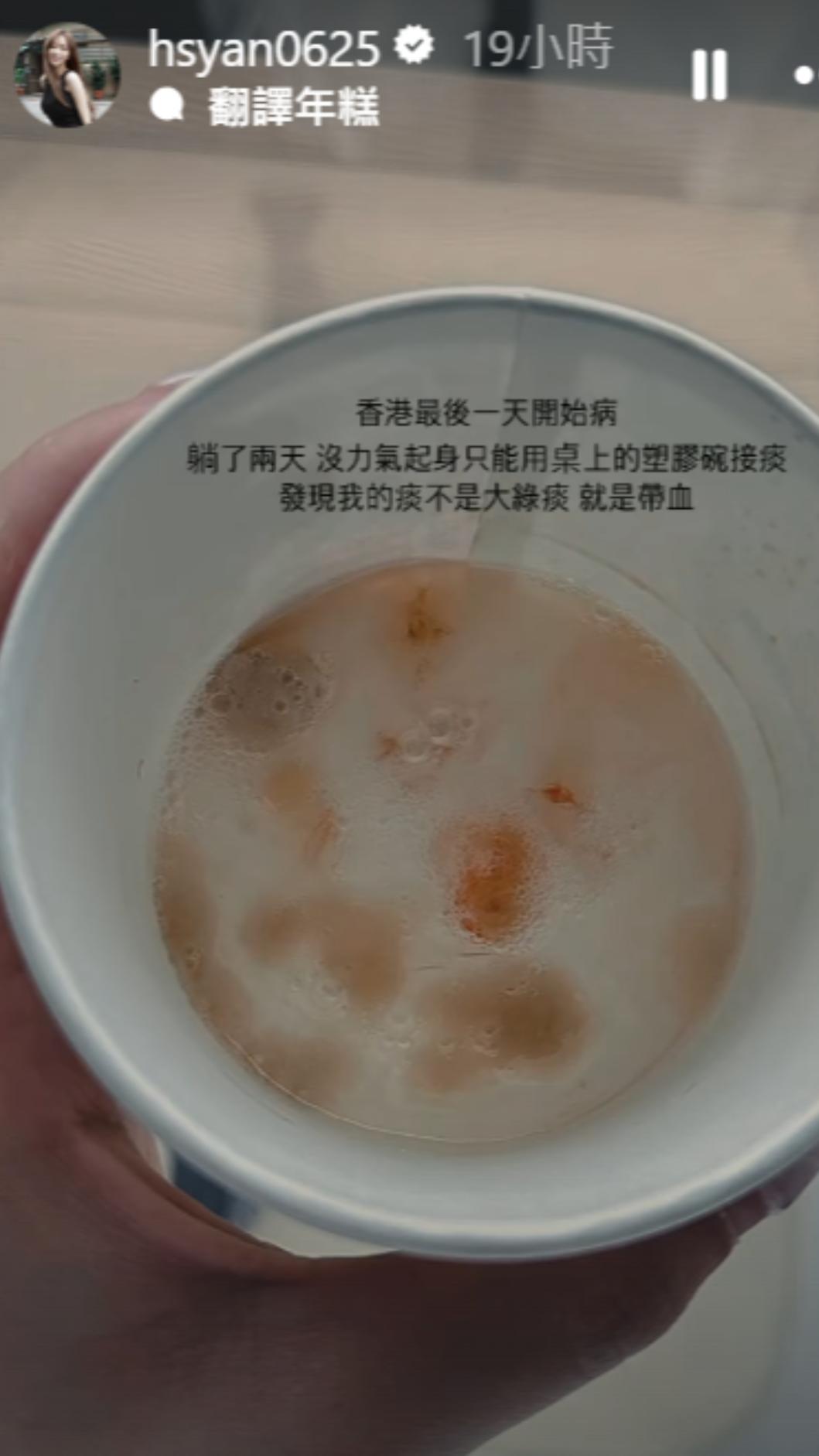 篠崎泫透露吐出來的痰都有血絲。（圖／翻攝自IG）