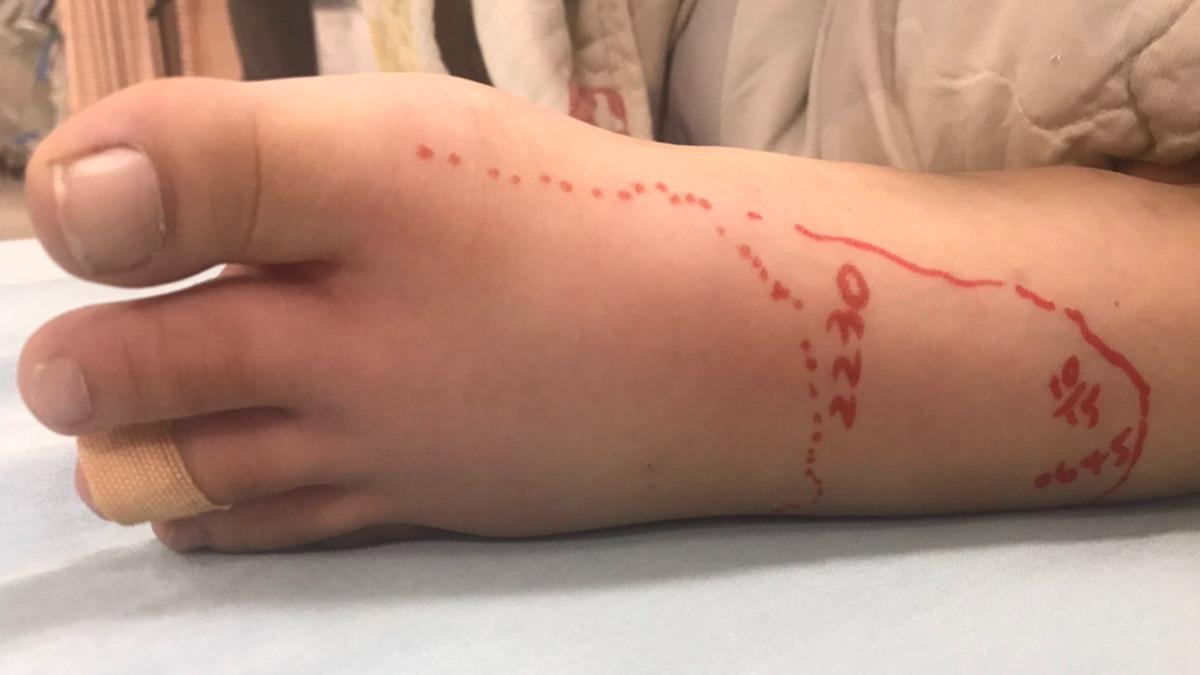 男童倒垃圾遭蛇咬。（圖／新上國小校長提供）