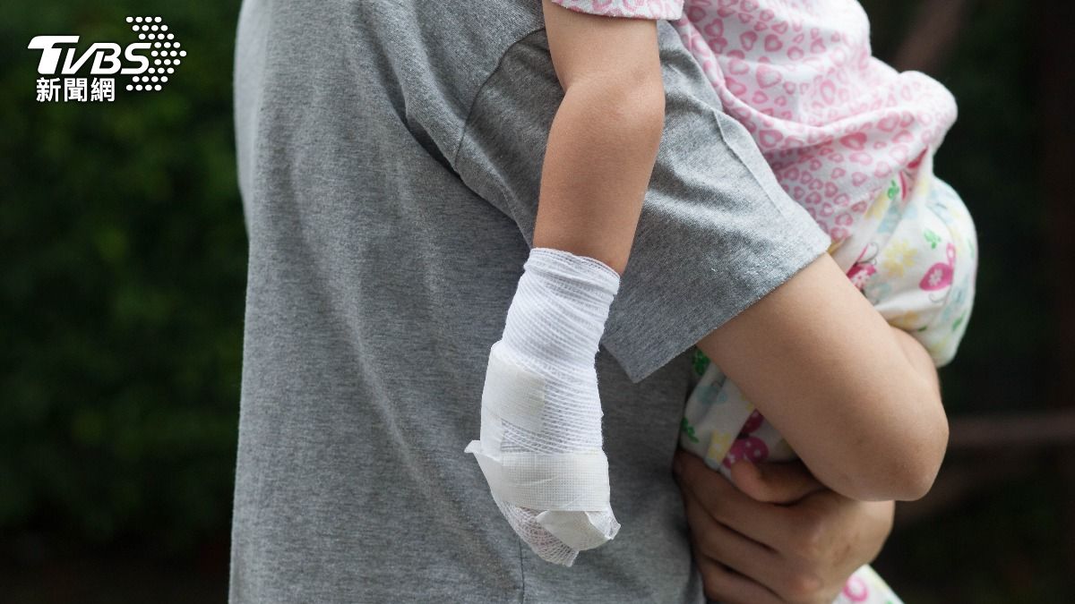 中國大陸一名6歲女童遭同學潑熱水受傷。（示意圖／Shutterstock達志影像）